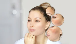 skin fix barrier cream